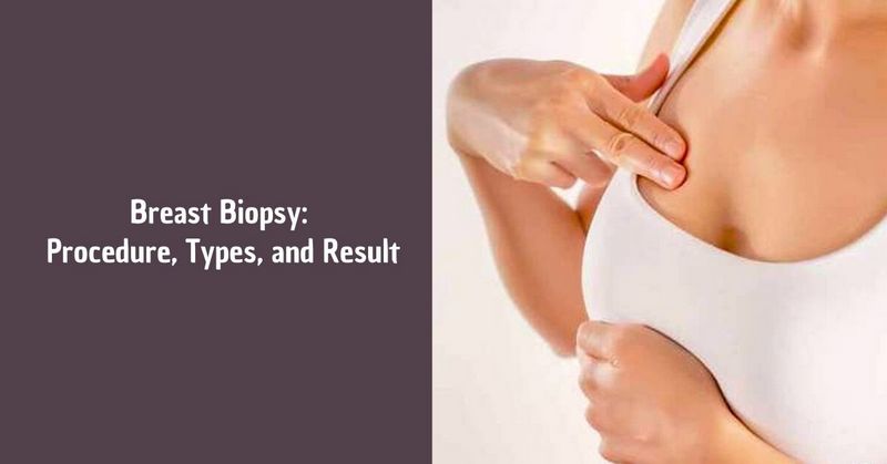 Breast Biopsy_ Procedure, Types, and Result