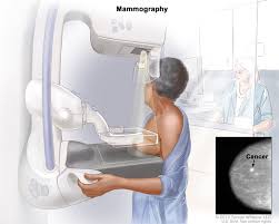 DIAGNOSTIC MAMMOGRAPHY