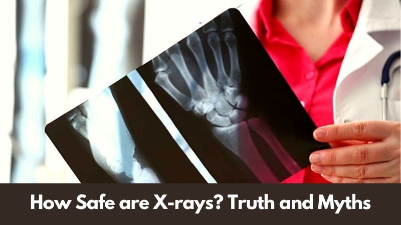 How Safe are X-rays Truth and Myths